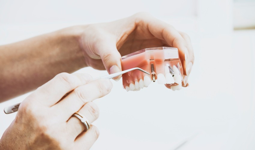 implant dentistry