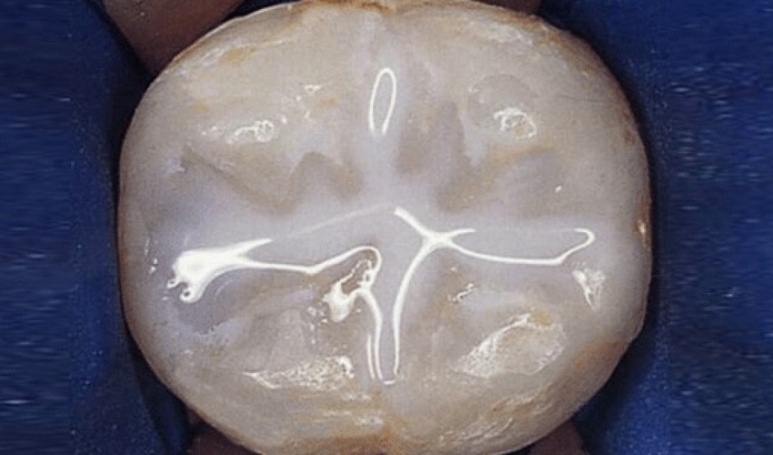 general dentistry