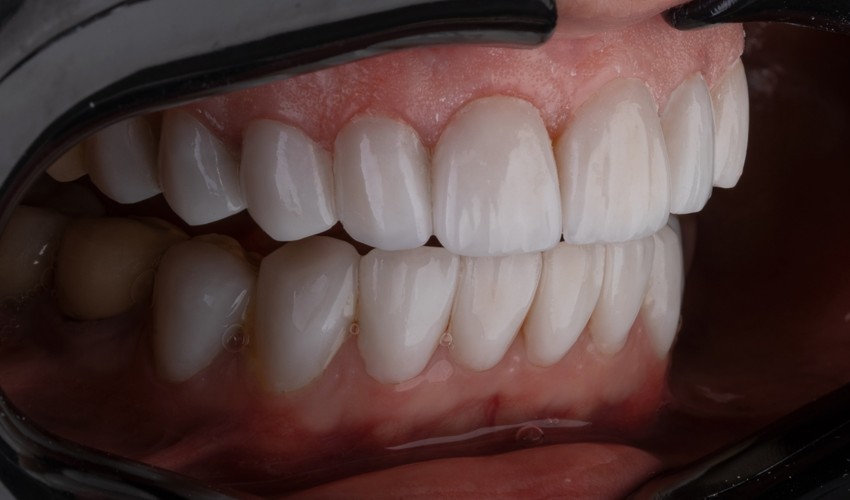 general dentistry
