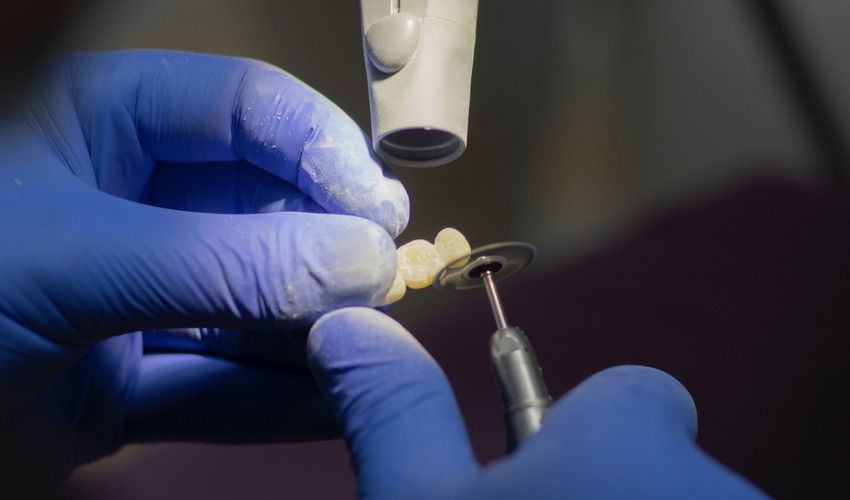 prosthetic dentistry