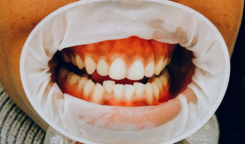 general dentistry