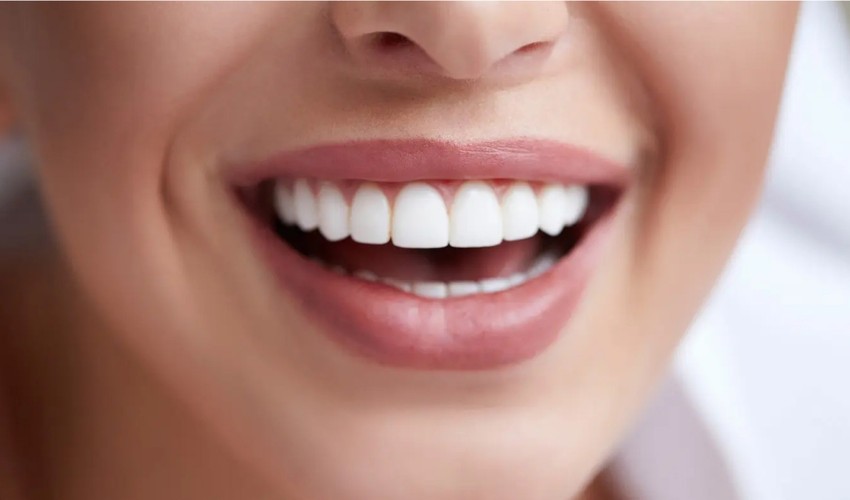 cosmetic dentistry